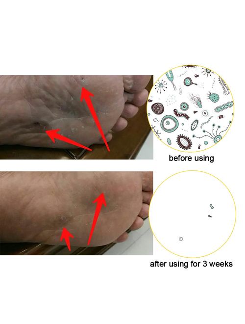 Toes&Feet Men's Anti Odor Quick-Dry Cushion Low-Cut Compression Running Socks