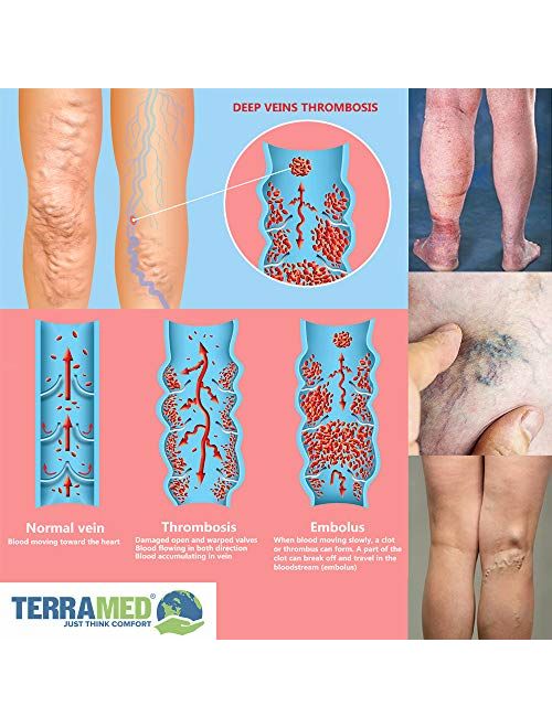 Terramed Advanced Graduated Compression Leggings Women - 20-30 mmHg Footless Microfiber Leggings Tights