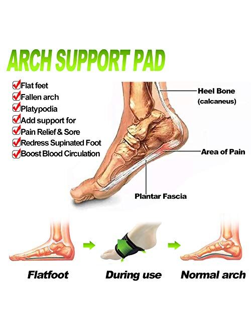 Ailaka 2 Pair Compression Cushioned Arch Support Brace, Plantar Fasciitis Sleeves for Pain Relief & Sore, Flat Feet, Heel Spurs