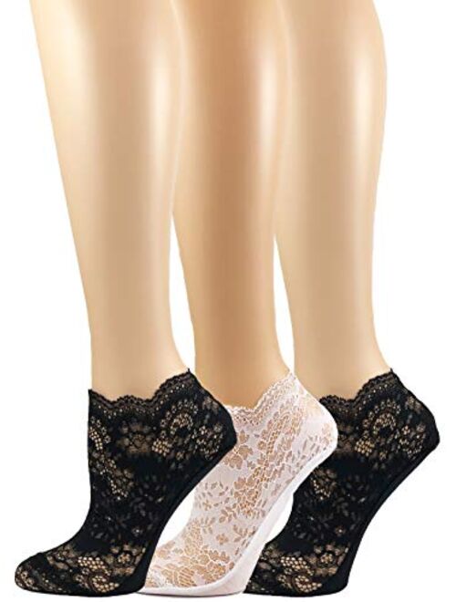 Felina | Lace Anklet Socks | 3-Pack
