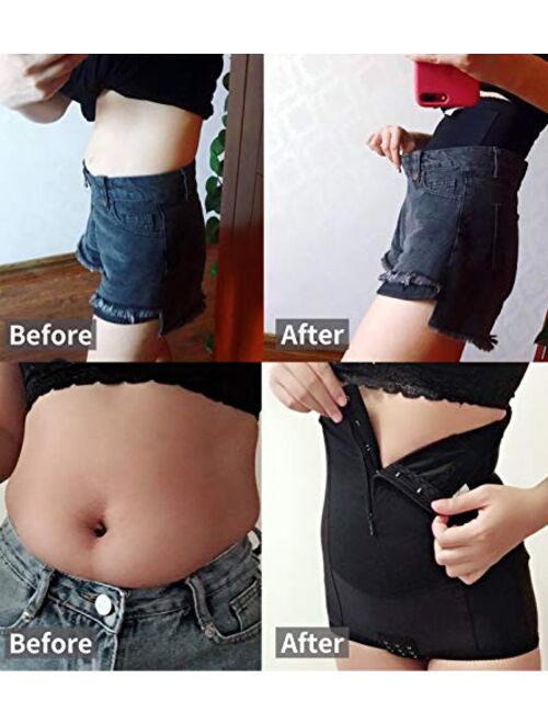 Movwin Postpartum Belly Wrap C Section Panty Belly Band Abdominal Compression Corset Girdle Shorts with Zipper