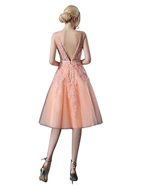 Beauty-Emily Lace Sleeveless Double V-Neck Knee Length Cocktail Gowns