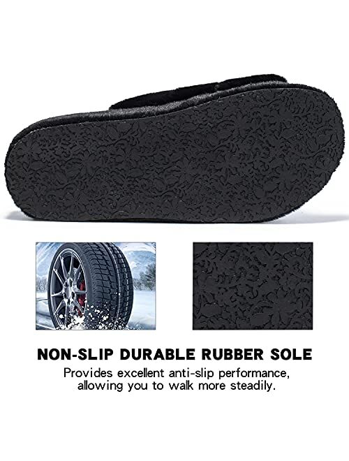 Nlissope Women's Orthopedic Slippers with Arch Support, Soft Plush Fuzzy Cozy Open Toe House Shoes for Plantar Fasciatis Foot & Heel Pain Slip On Slippers Indoor Outdoor